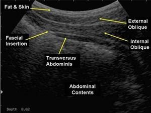 Abdominal-ultrasound